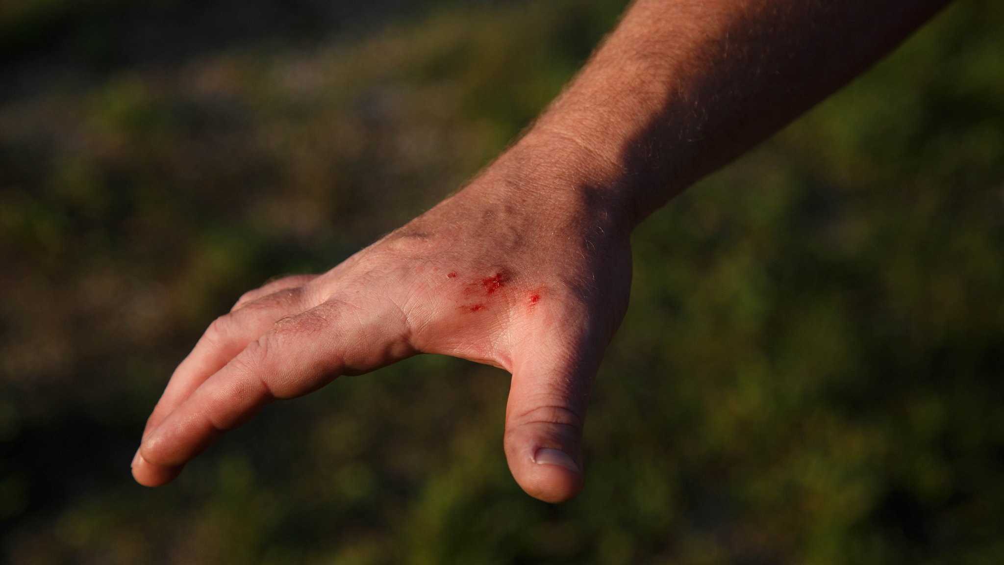 Slide Bite